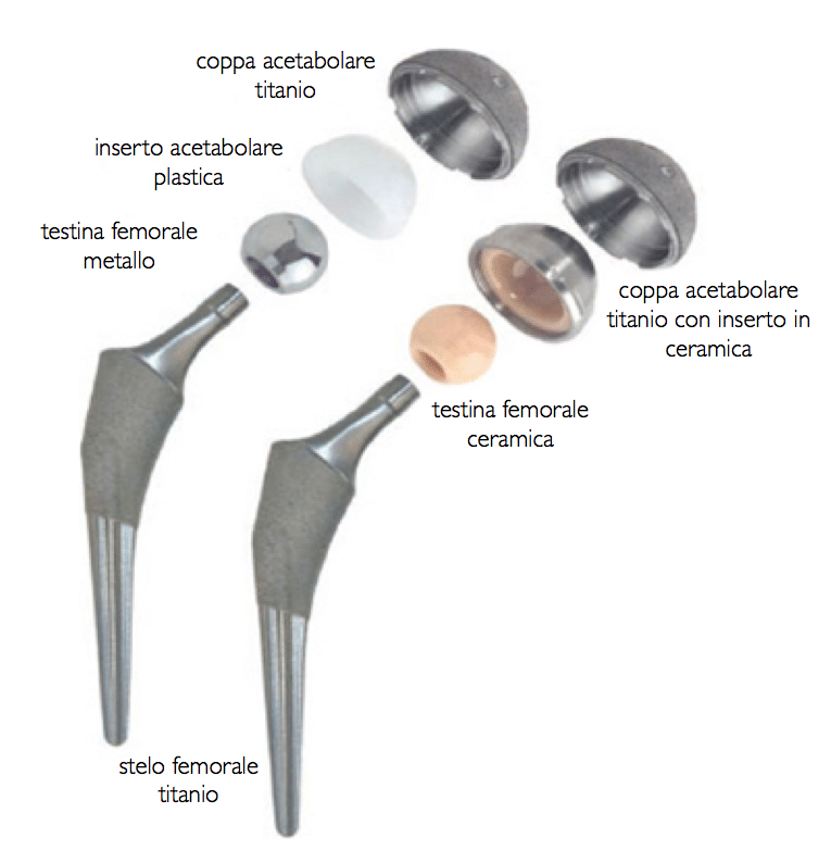 ortopedico protesi d'anca