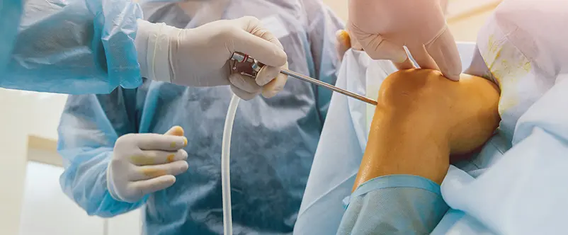 frattura della rotula roma