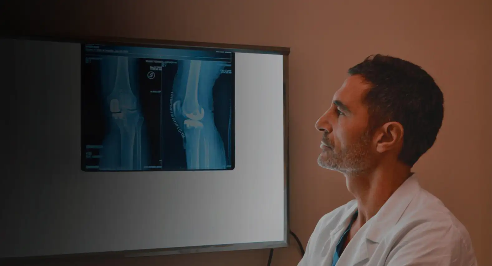 paolo lucci ortopedico-ginocchio anca roma