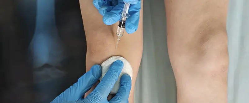 infiltrazioni ginocchio