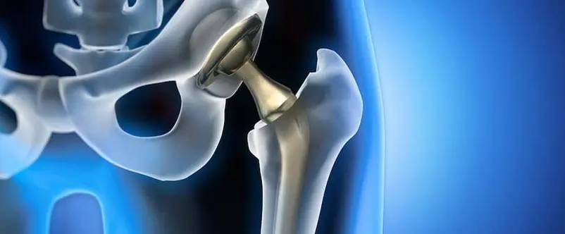 ortopedico anca roma